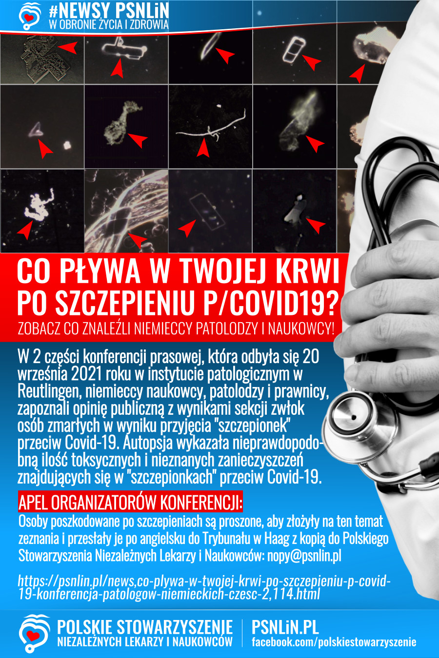 Newsy_PSNLiN-Co_pływa_w_twojej_krwi_po_zaszczepieniu_przeciw_Covid_19-Konferencja_patologów_niemieckich