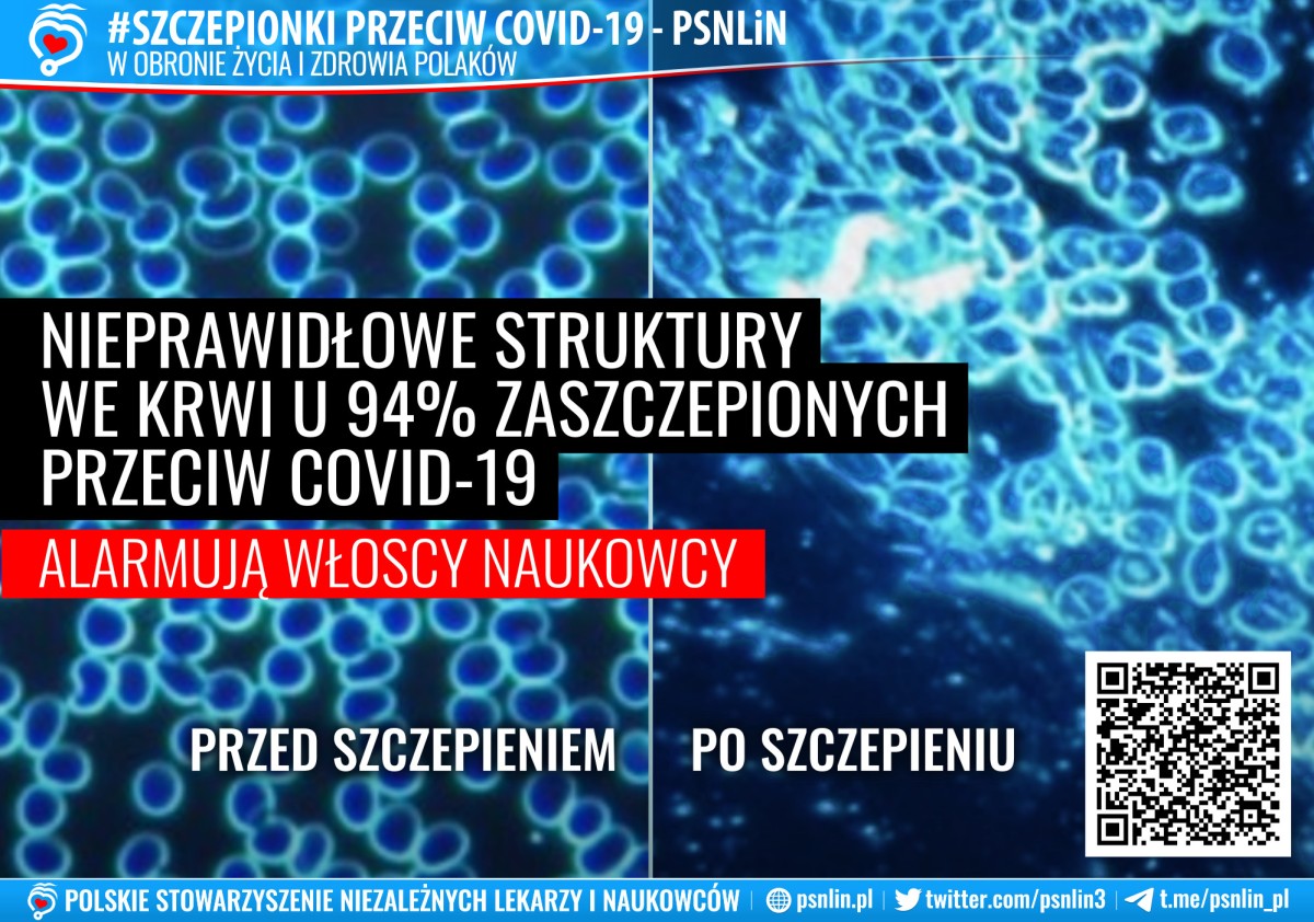 Szczepionki_przeciw_Covid-19-PSNLiN-Nieprawidłowe_struktury_we_krwi_u_94%_zaszczepionych_przeciw_Covid-19