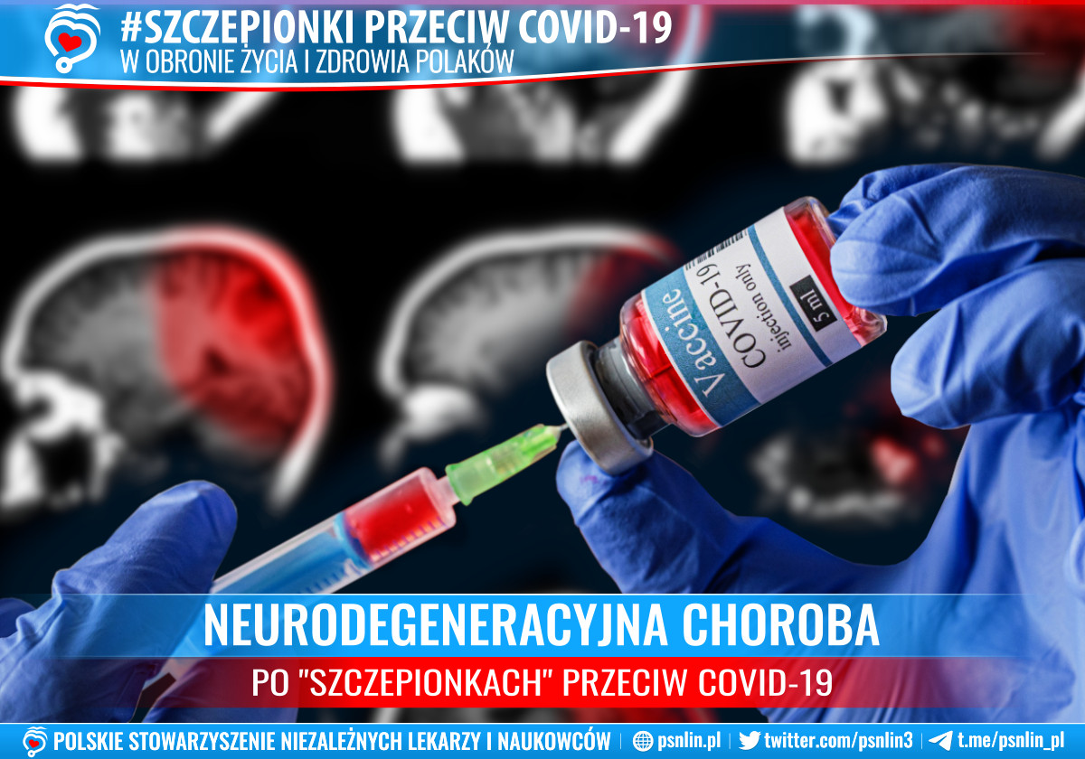 Szczepionki_przeciw_Covid-19-wywołują_neurodegeneracyjną_chorobę_Creutzfeldta-Jakoba